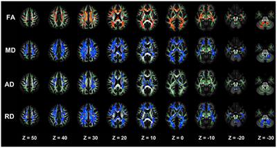 Diffusion tensor imaging of the brain white matter microstructure in patients with chronic kidney disease and its correlation with cognition